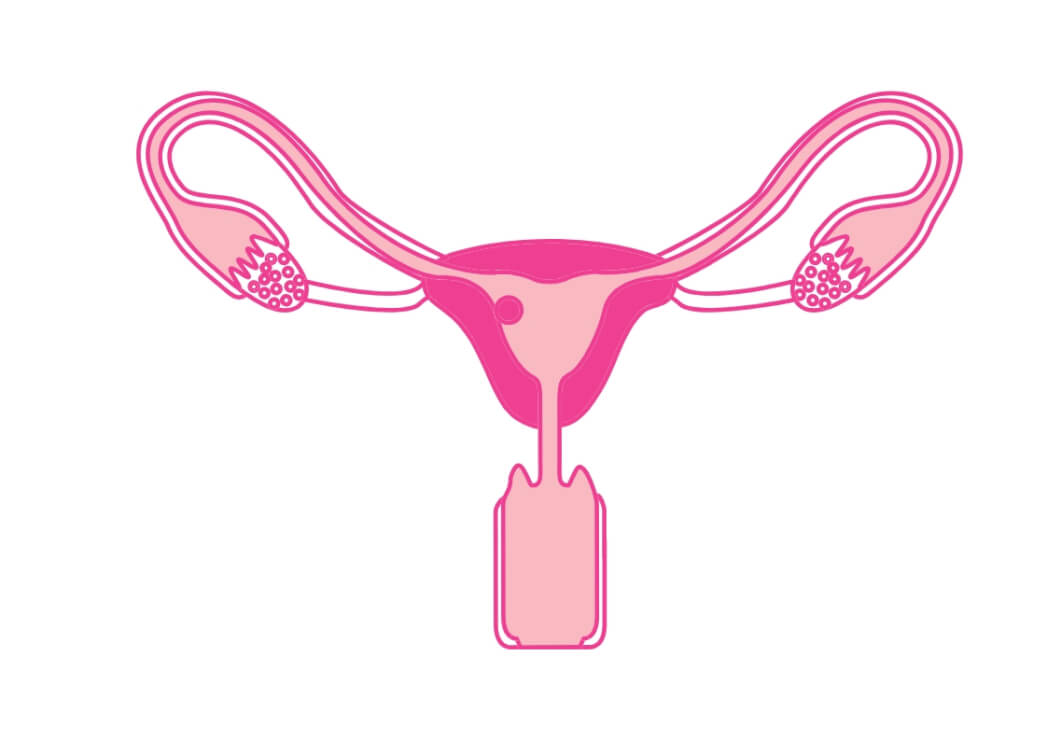 menstruatie pcos mamameteenblog.nl