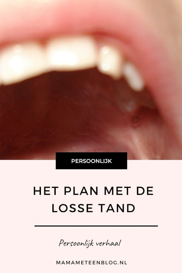 Het plan met de losse tand mamameteenblog.nl